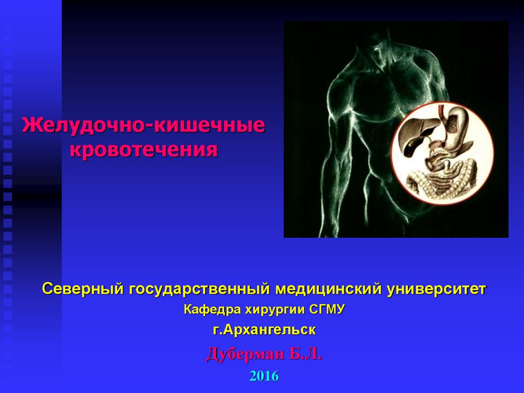 Желудочно кишечные кровотечения язвенной этиологии презентация