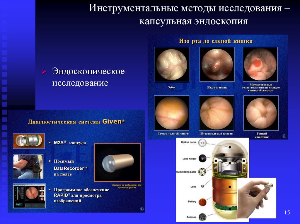 Капсульная эндоскопия картинки