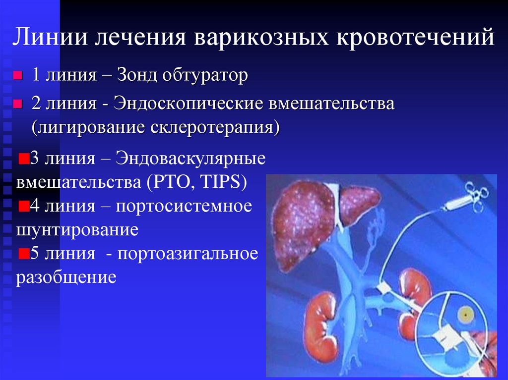 Желудочный кровотечение тесты. Кровотечение тонкого кишечника. Источники кровотечения. Причины желудочно-кишечных кровотечений с фиброзом печени. Ректальный осмотр при кишечном кровотечении.