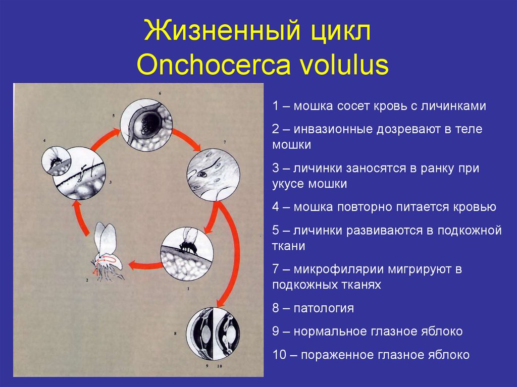 2 жизненный цикл. Цикл развития Онхоцерка. Жизненный цикл мошки. Онхоцерка жизненный цикл. Онхоцеркоз жизненный цикл.