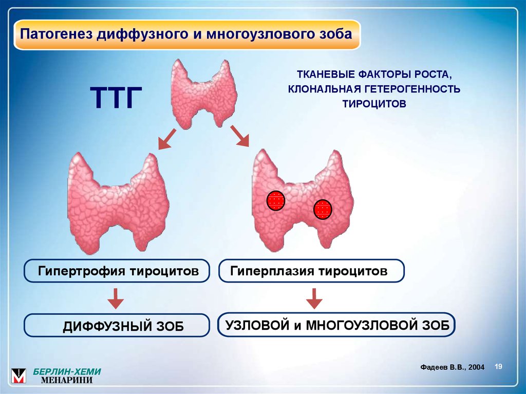 Причины диффузного зоба. Узловатый гипертиреоидный зоб патогенез. Узловой токсический зоб патогенез. Разрастание щитовидной железы. Этиология зоба щитовидной железы.