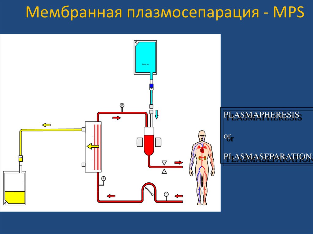 Плазмаферез краснодар. Мембранный плазмаферез. Плазмаферез картинки для презентации. Терапевтический плазмообмен. Мембранный плазмаферез показания.