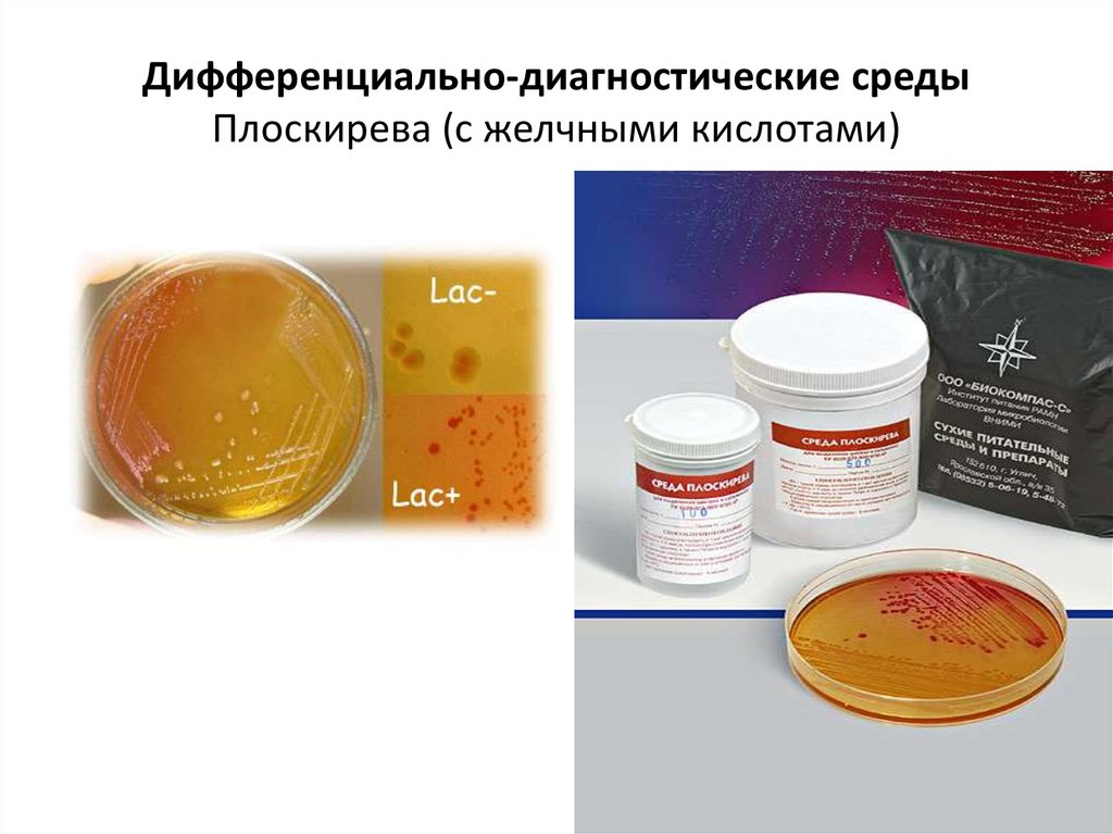 Дифференциально диагностические. Дифференциально-диагностические среды Эндо и Плоскирева. Среда Плоскирева дифференциально диагностическая. Дифференциально диагностические среды Эндо Левина. Среда Плоскирева микробиология.