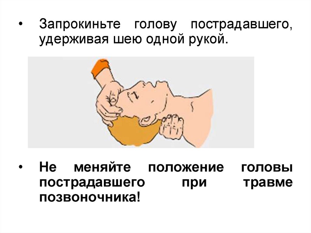 Запрокинуть голову назад. Запрокидывание головы пострадавшего. Запрокидывание головы пострадавшего необходимо. Как запрокинуть голову пострадавшего. Запрокиньте голову пострадавшего.