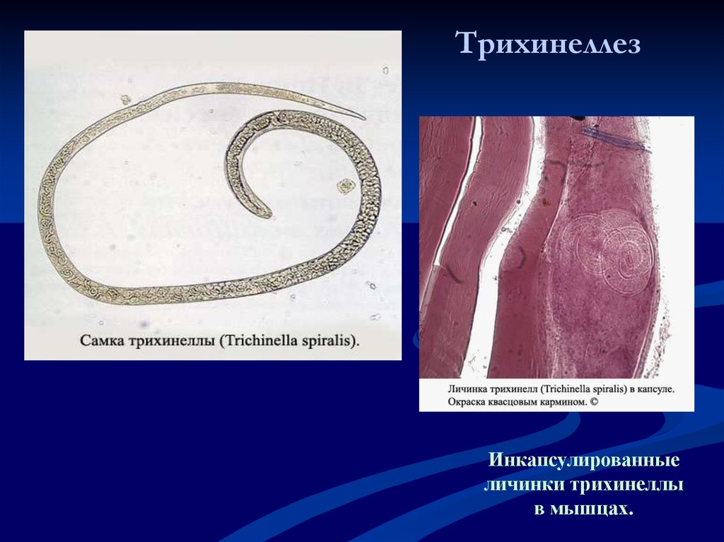Личинки трихинеллы. Трихинелла спиральная - Trichinella spiralis. Трихинелла Спиралис личинки. Паразитические круглые черви трихинелла.