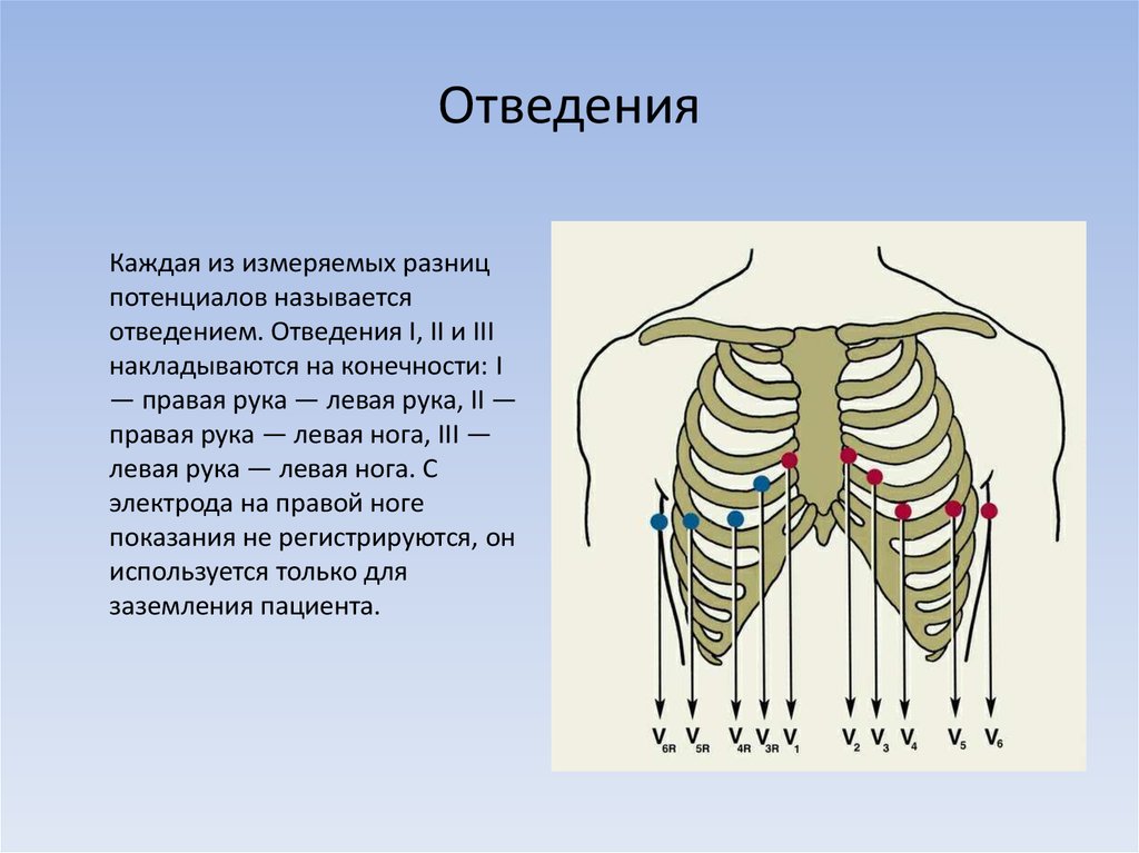 Правые отведения