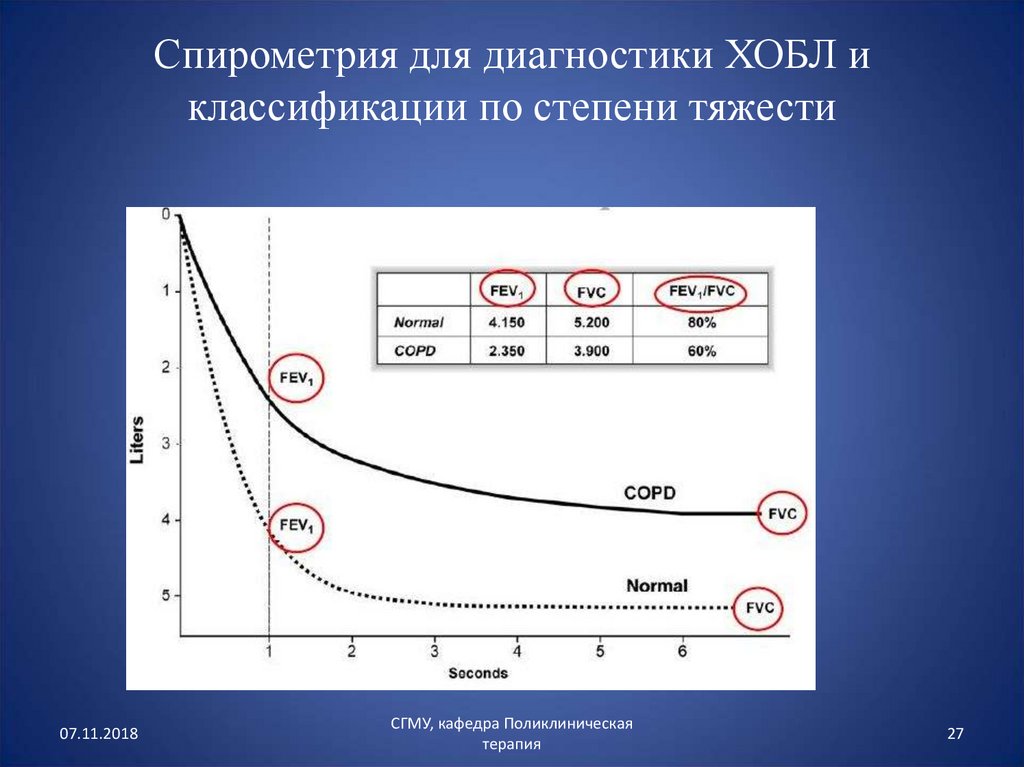 Презентация по спирометрии