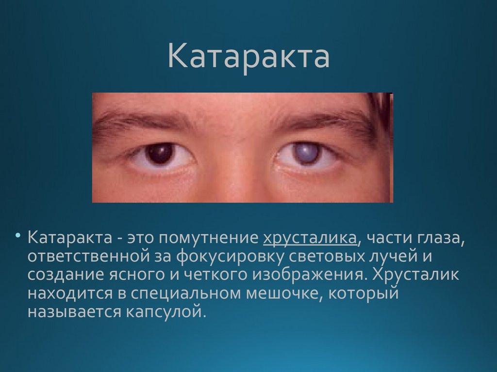 Заболевания глаз биология 8. Гигиена зрения и болезни глаз. Презентация болезни глаз. Профилактика глазных болезней.