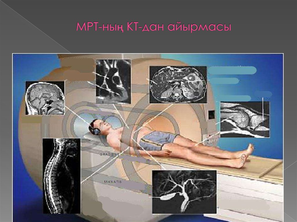 Мрт методика получения изображения