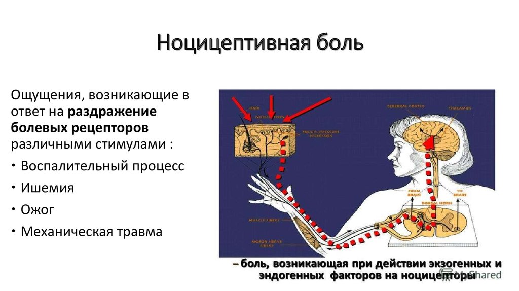 Причина болевых ощущений. Патофизиология боли. Ноцицептивная системы. Ноцицептивная боль возникает при. Механизм формирования ноцицептивной боли.