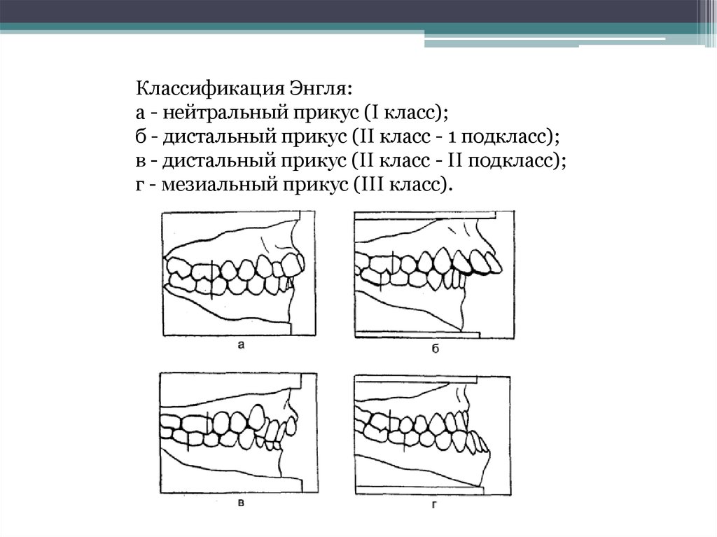 Мезиальная окклюзия презентация ортодонтия