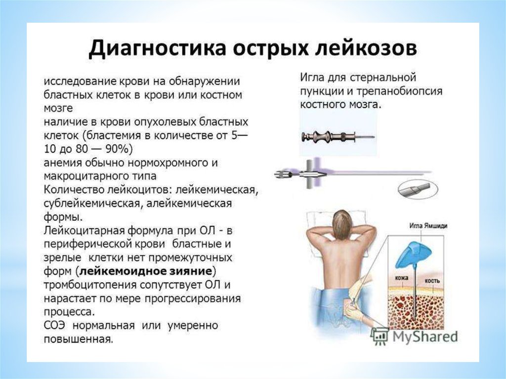 Подготовка к стернальной пункции алгоритм