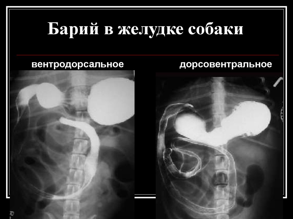 Рентген с барием москва. Контрастная рентгенография желудка.