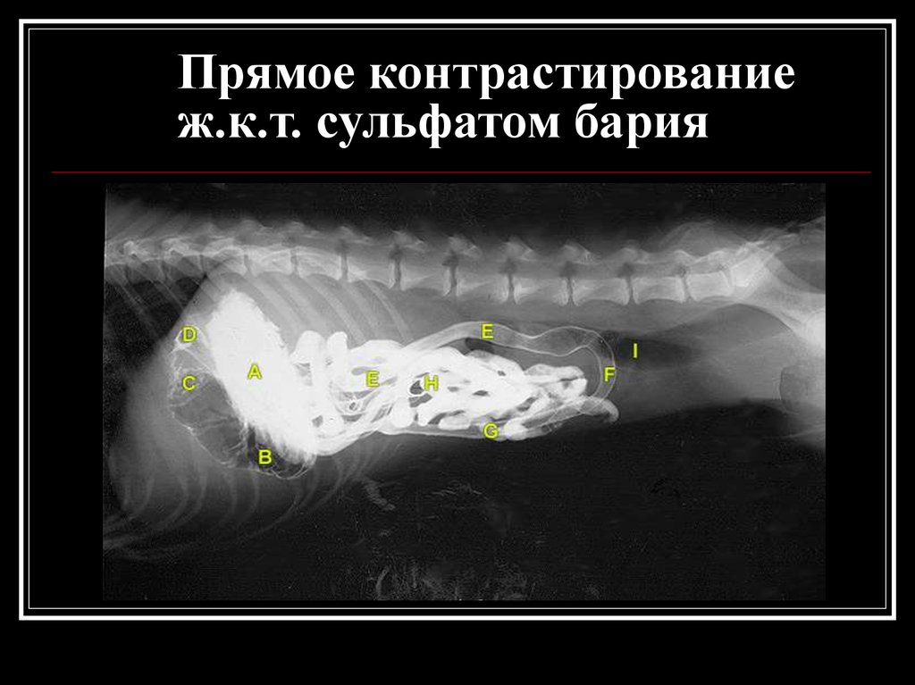 Рентгеноконтрастный барий. Прямое контрастирование. Контрастирование сульфатом бария. Контрастирование желудка сульфатом бария. Рентгенология.