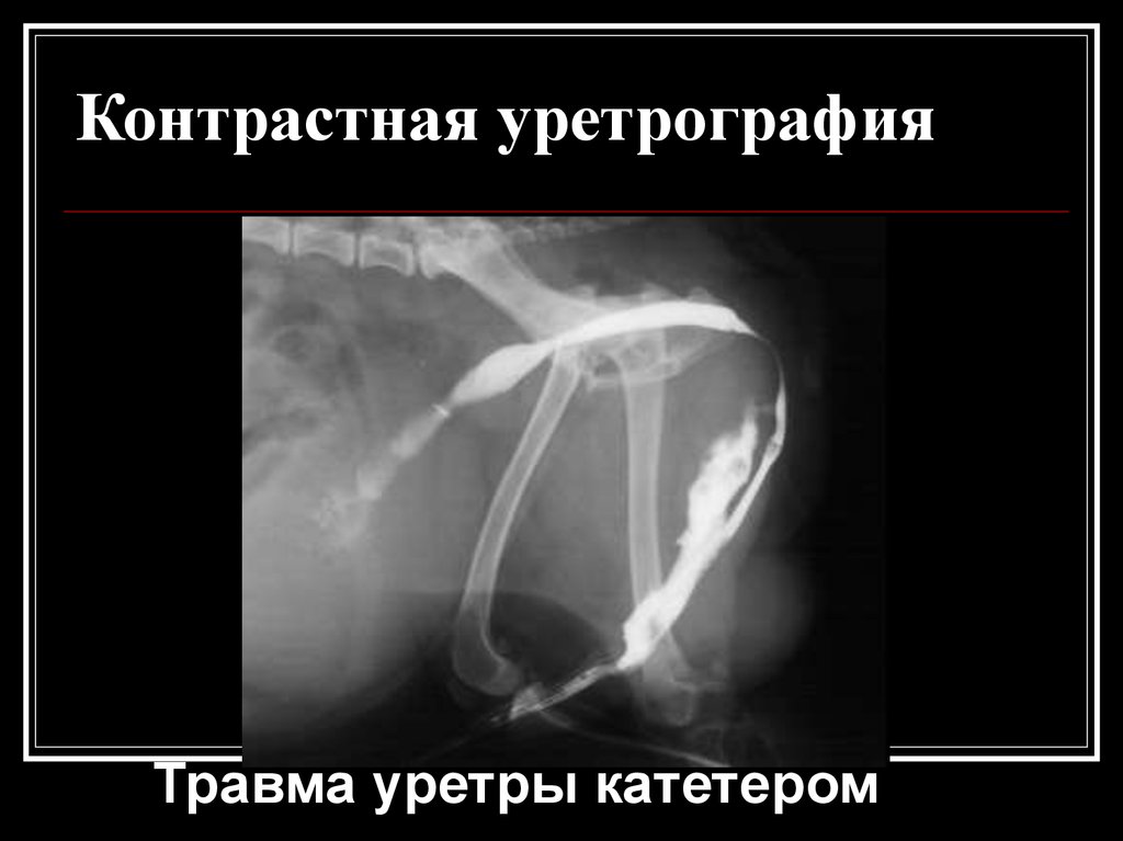 Травмы уретры презентация