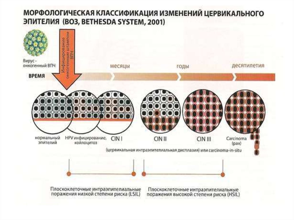 Интраэпителиальное поражение hsil. Классификация дисплазии эпителия шейки матки. Морфологическая классификация эпителиев. Высокоонкогенные ВПЧ. Классификация цитологии шейки матки.