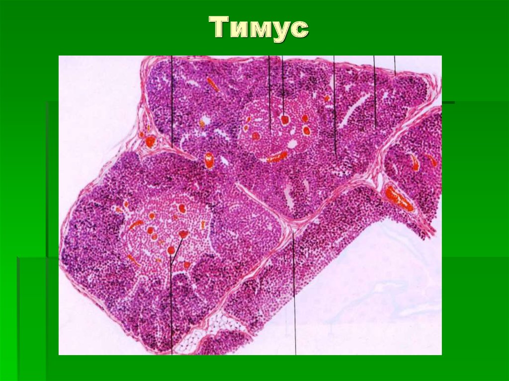 Тимус новорожденного гистология рисунок
