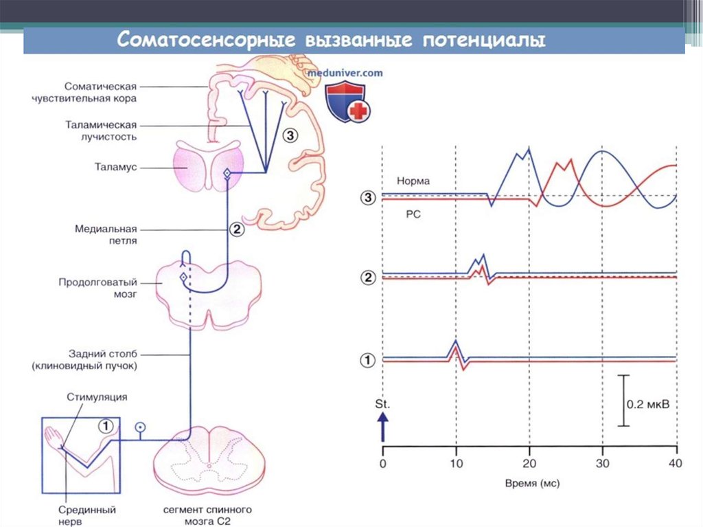 Исследование потенциала. Регистрация зрительно вызванных потенциалов коры головного мозга. Вызванные зрительные, слуховые, соматосенсорные потенциалы. Исследование соматосенсорных вызванных потенциалов. Соматосенсорные вызванные потенциалы с нижних конечностей.