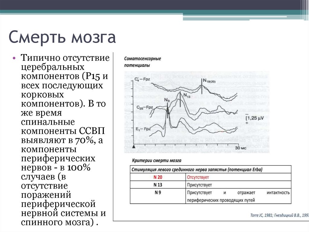 Смерть мозга. Соматосенсорные вызванные потенциалы (ССВП).