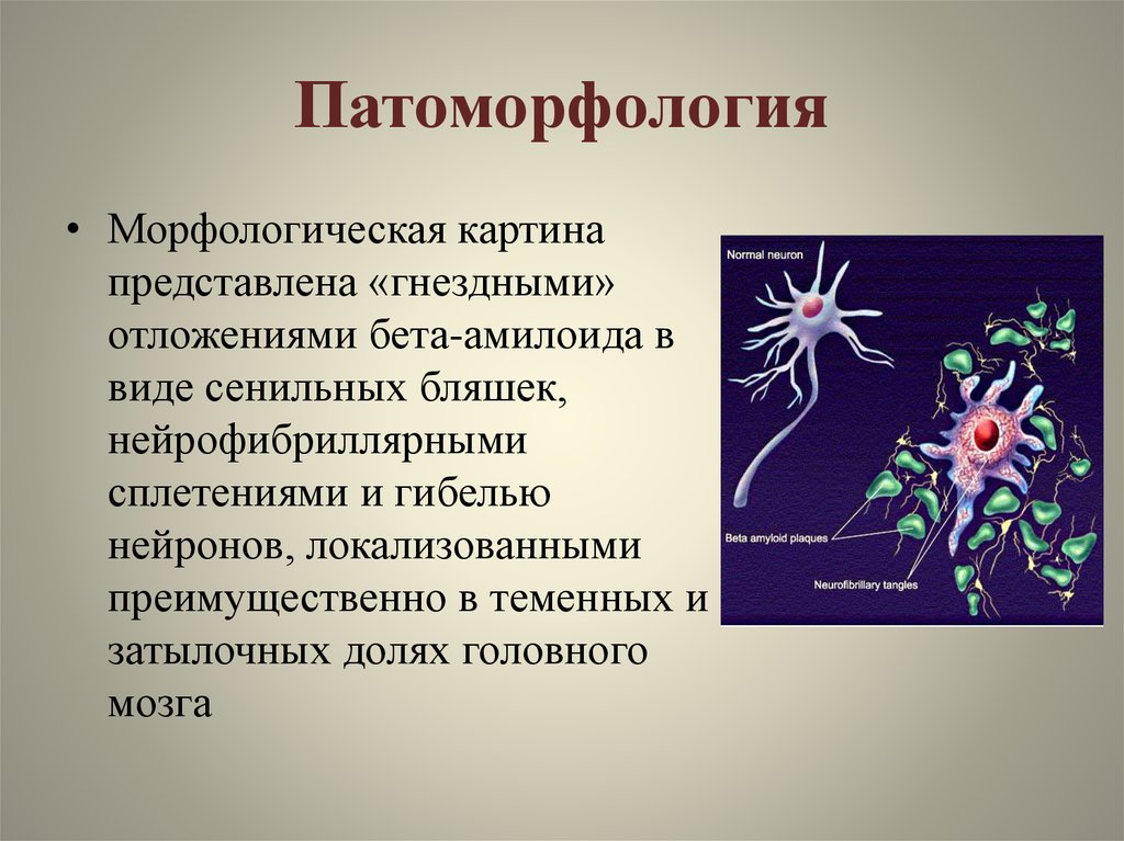 Нейродегенеративные заболевания головного мозга. Нейродегенеративные заболевания. Нейрофибриллярный аппарат нейрона.