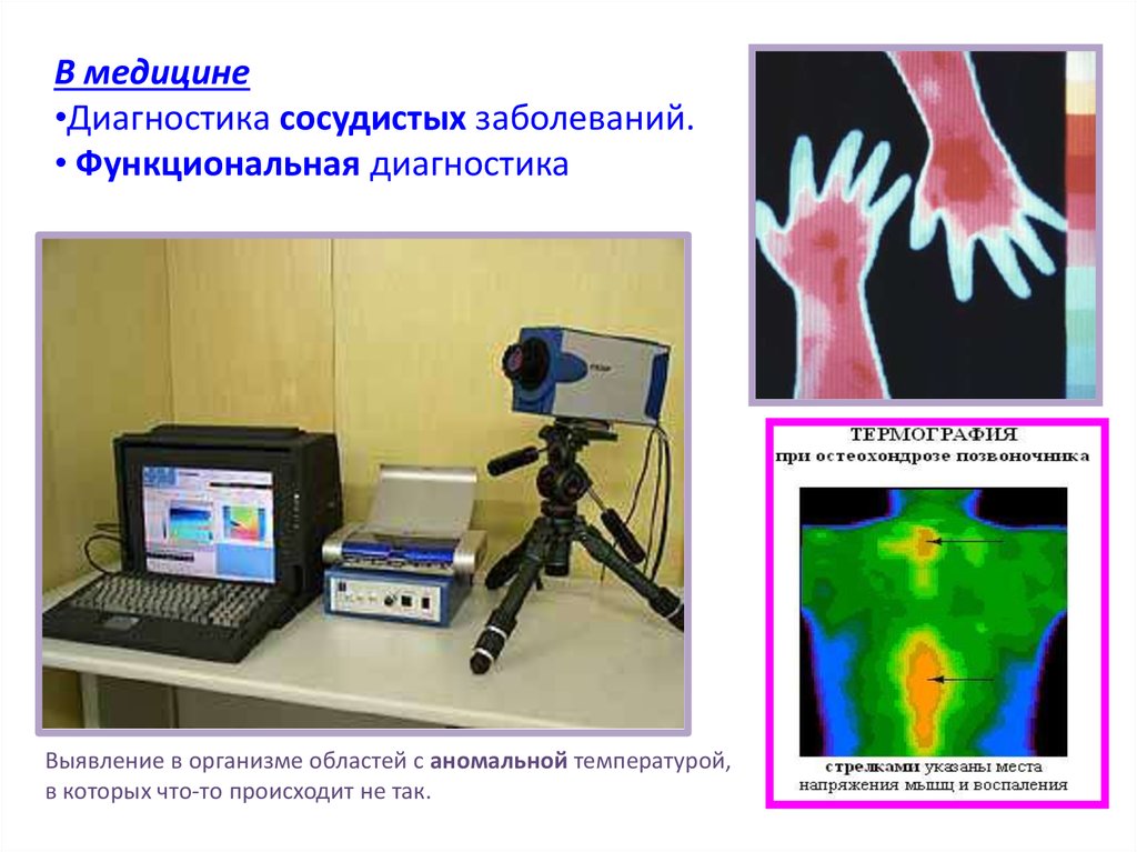 Медицинская термография презентация