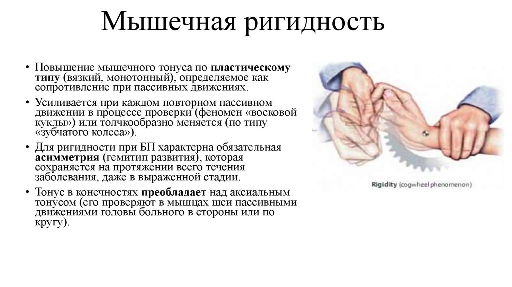 Ригидность мышц. Феномен зубчатого колеса при болезни Паркинсона. Тонус мышц по типу зубчатого колеса. Симптомы ригидности мышц. Симптом зубчатого колеса.