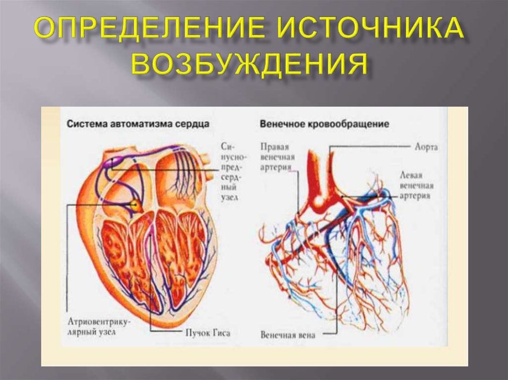 Определение источника возбуждения водителя ритма