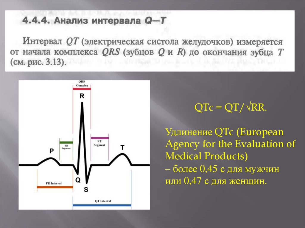 Интервал qt холтер. QTC норма ЭКГ. Отрицательный зубец р после QRS комплекса. Синдром удлиненного интервала qt. Qt QTC на ЭКГ норма.