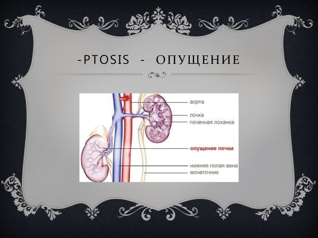 -ptosis - опущение