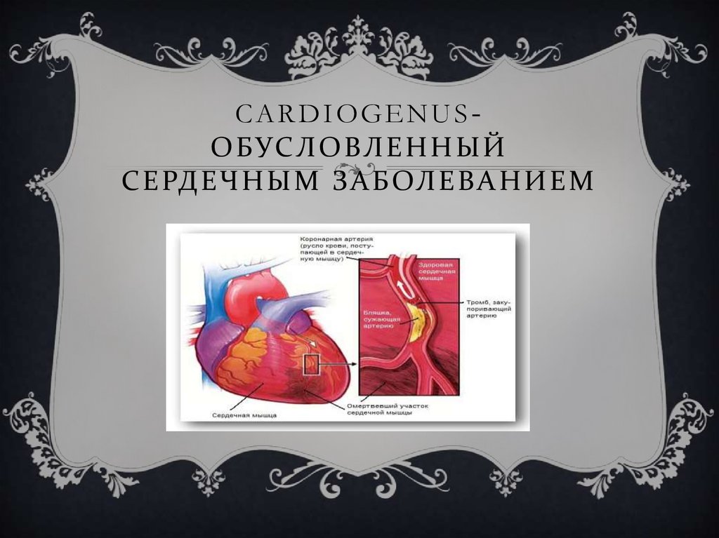 cardiogenus- Обусловленный сердечным заболеванием