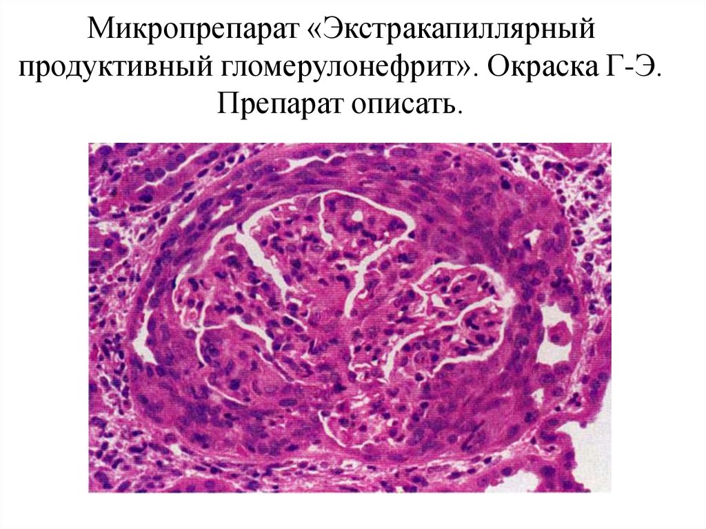 Хроническое венозное полнокровие печени микропрепарат рисунок