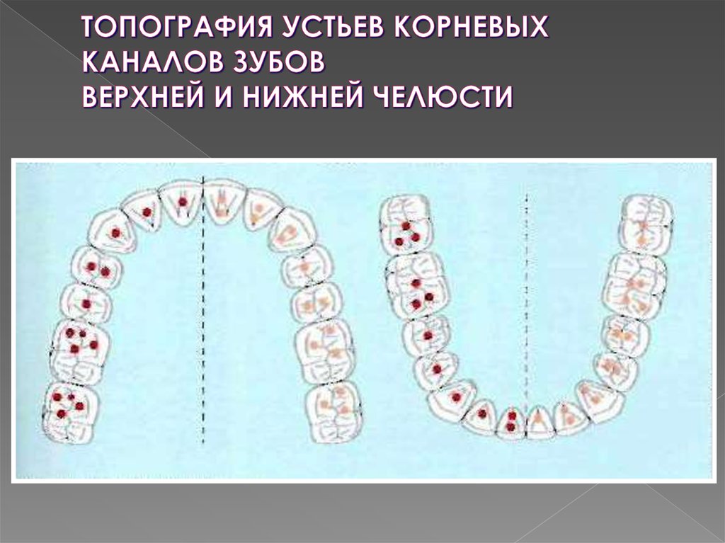 Зуб семерка верхний. Корневые каналы верхней челюсти. Анатомия корневых каналов зуба 2.6. Анатомия корневых каналов 16 зуба. Топография устьев корневых каналов зубов нижней челюсти.