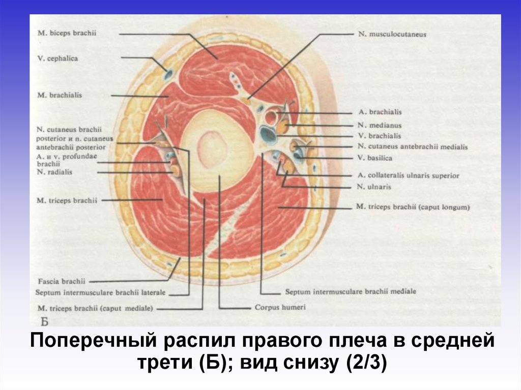 Поперечный распил малого таза на уровне 2 этажа схема