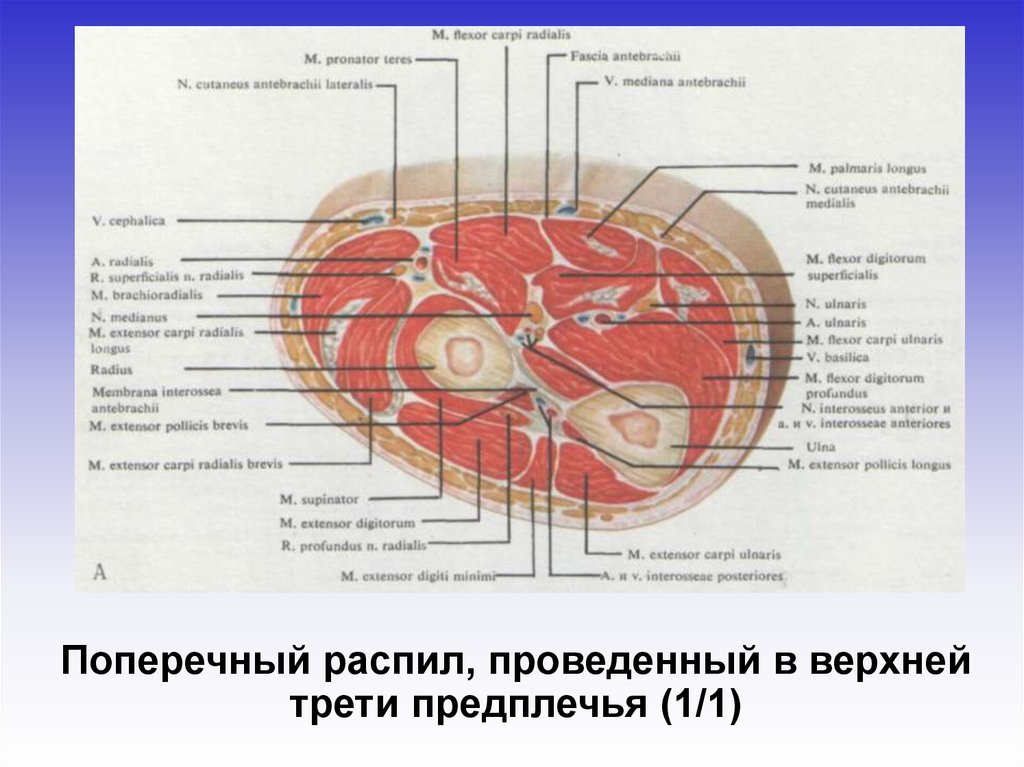 Верхней трети