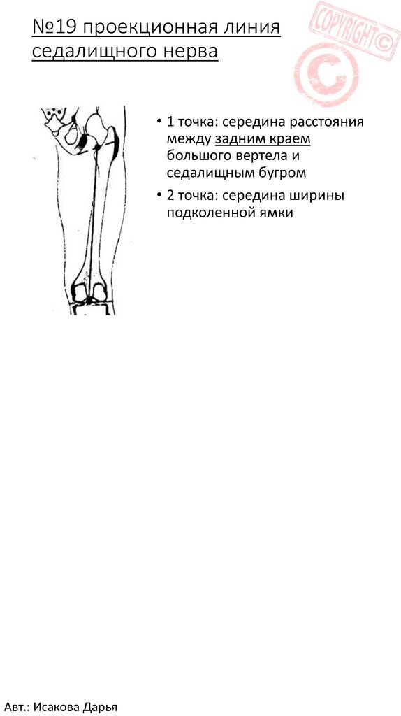 Проекционная линия лучевой артерии