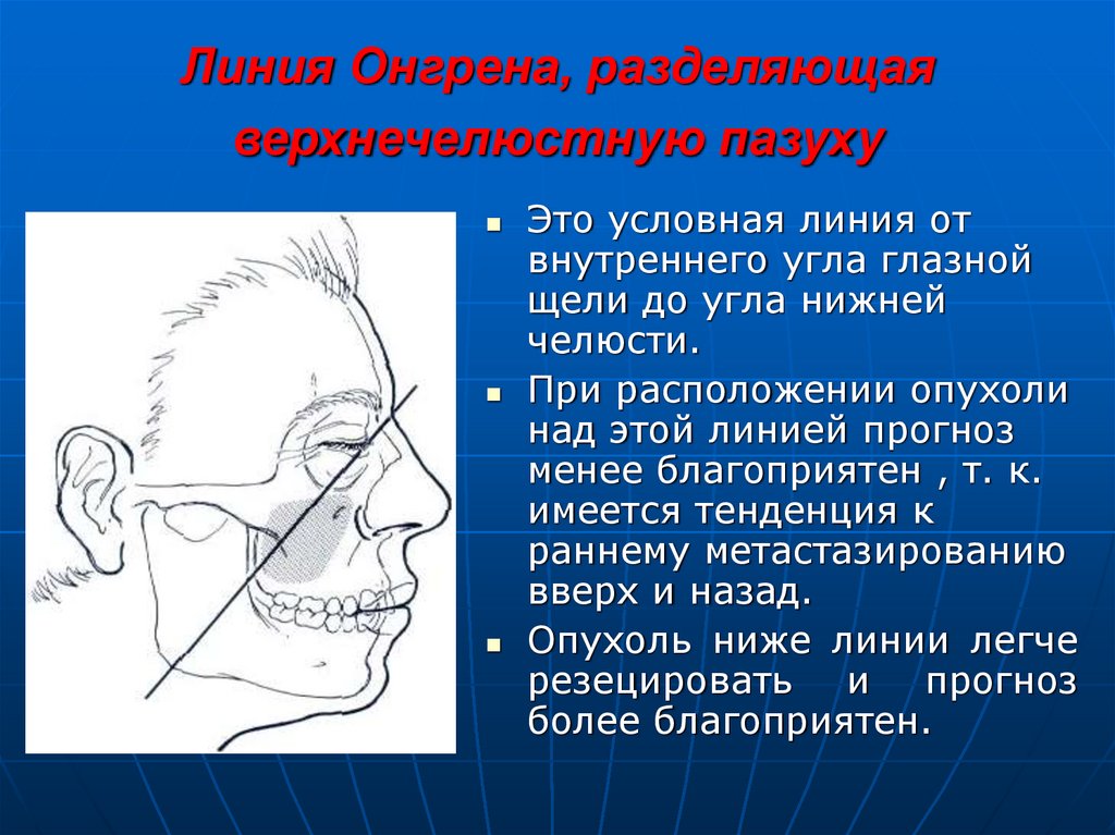 Угол болеть. Деление верхнечелюстной пазухи по Онгрену.