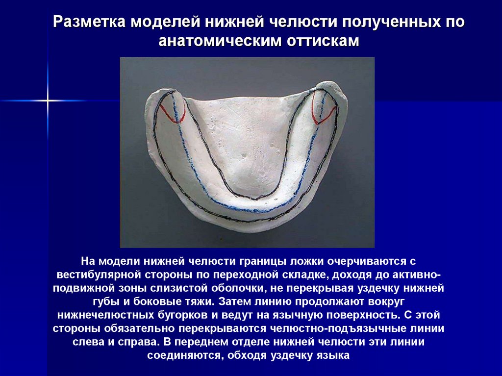 Анатомические предпосылки стоматологической имплантации презентация