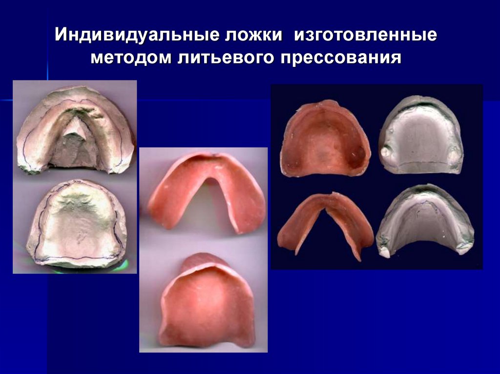 Оттиски в ортопедической стоматологии презентация