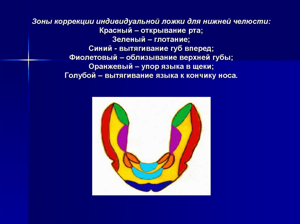 Припасовка индивидуальной ложки на верхней челюсти проводят по следующему плану