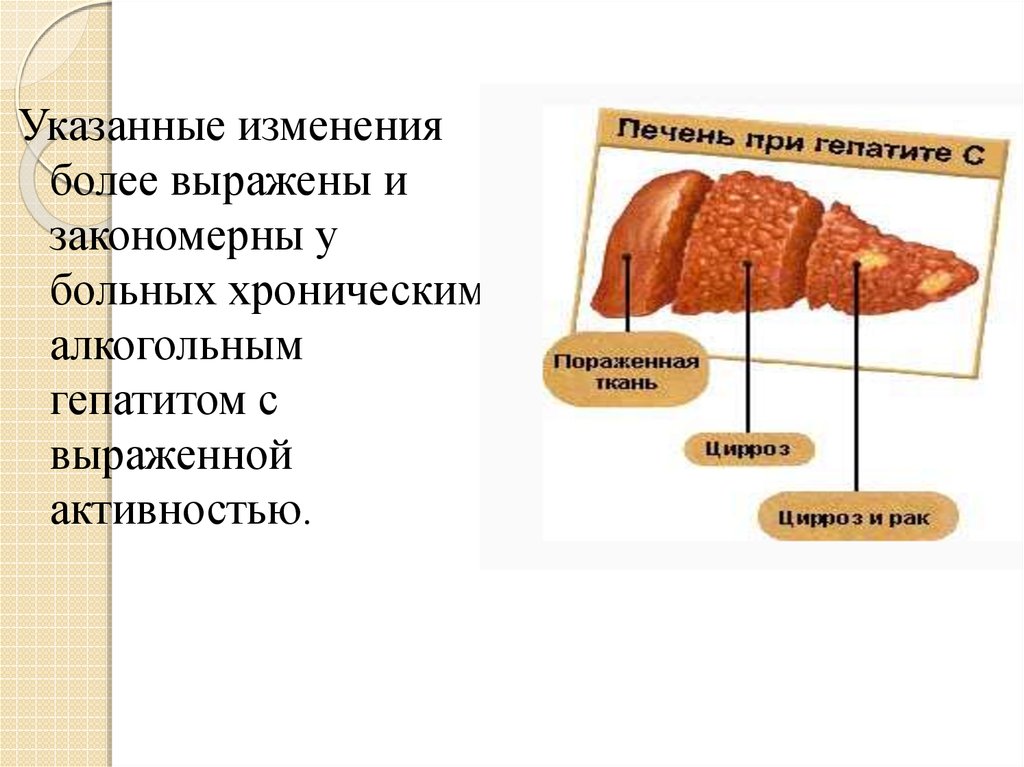 Указанные изменения. Ночная активность печени. Алкогольный гепатит презентация. Час активности печени. Биологическая активность печени.