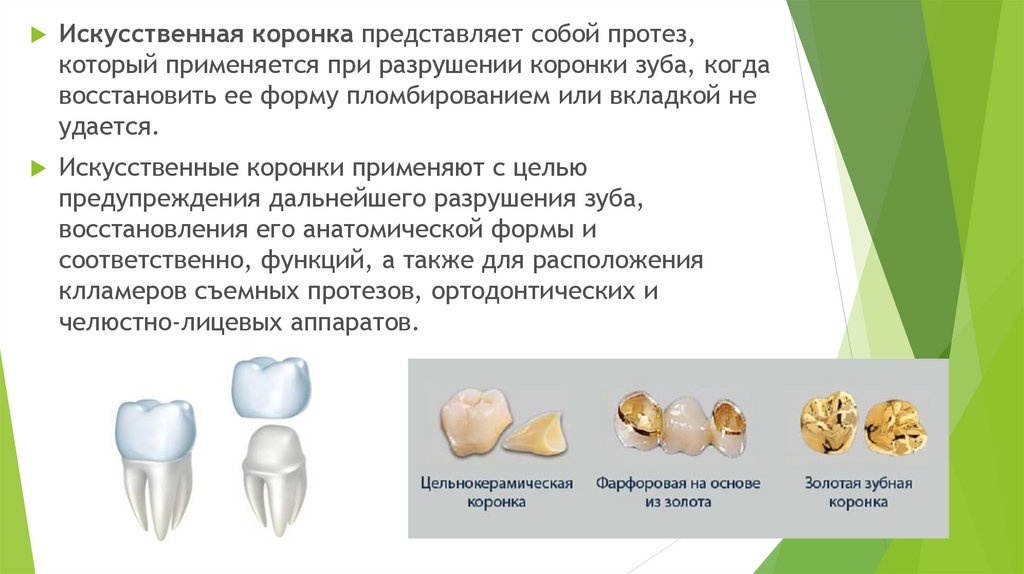 Штампованные коронки презентация