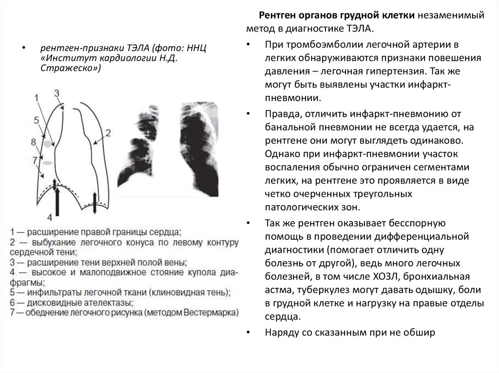 План описания рентгенограммы легких