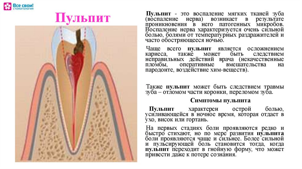 Лечение пульпита Томск Континентальная стоматология на иркутском тракте в томске адреса