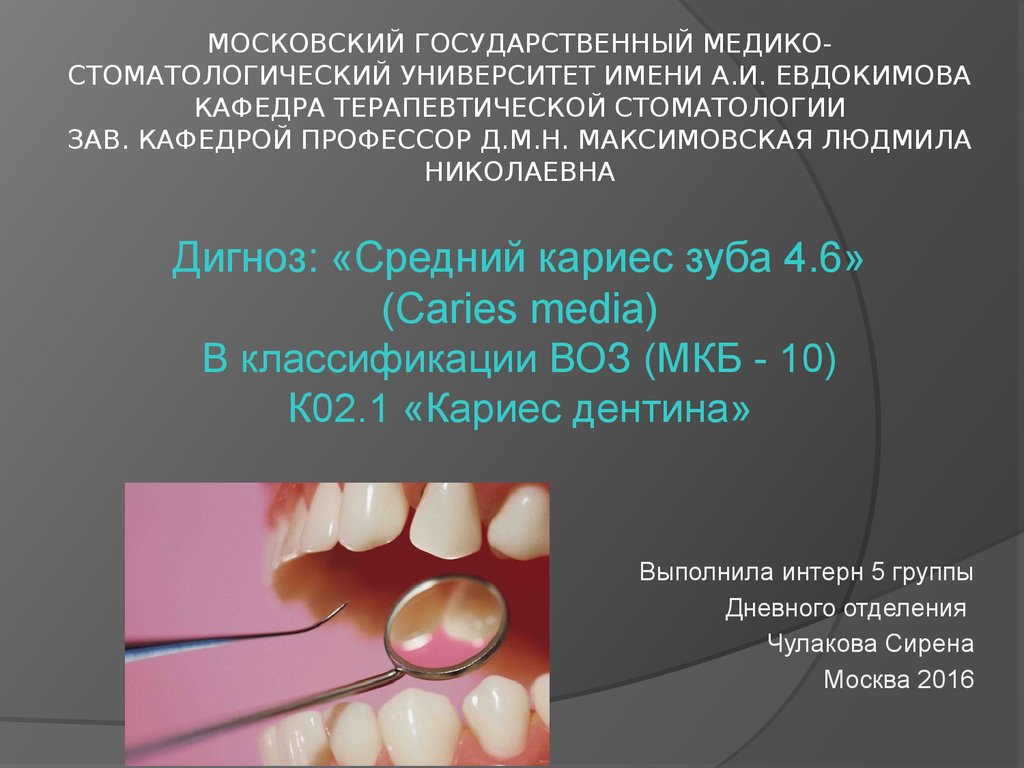 Кариес дентина мкб. Кариес мкб. Мкб 10 кариес зубов. Классификация кариеса мкб. Мкб 10 стоматология кариес.