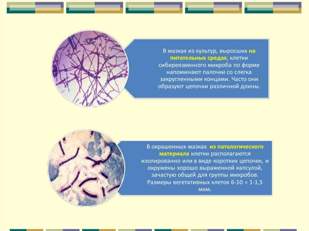 Презентация по микробиологии сибирская язва