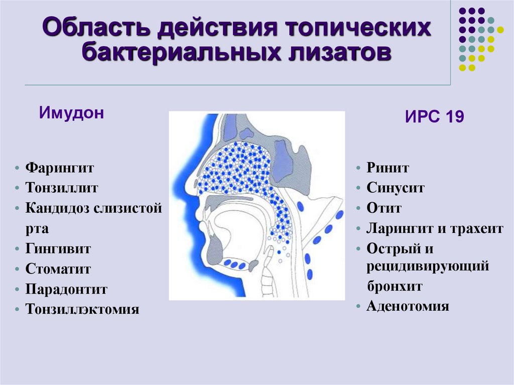 Ответы на тесты острый синусит