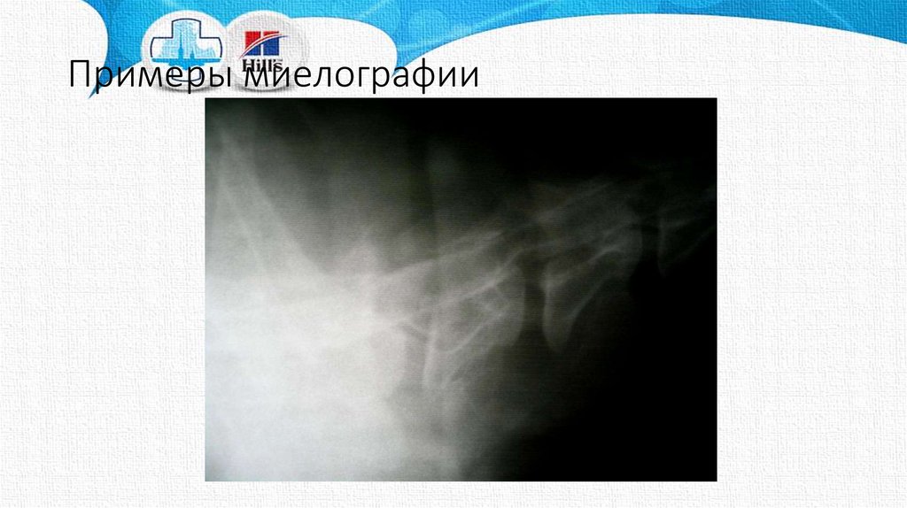 Шаблоны презентаций рентген