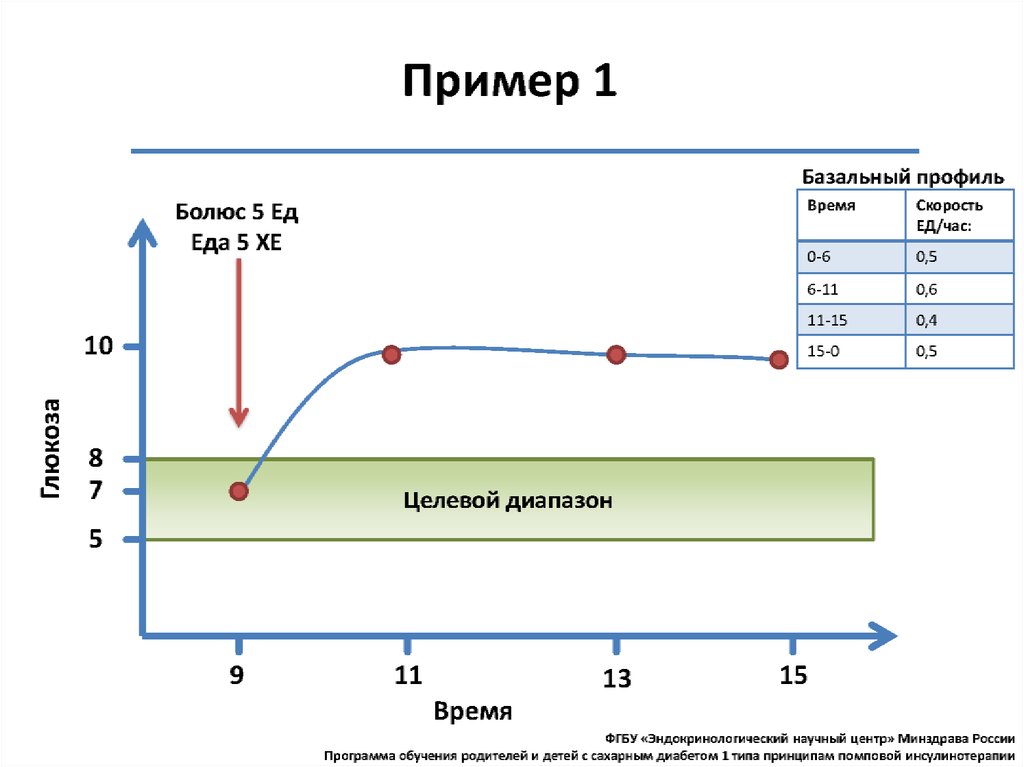 Схема инсулинотерапии у беременных