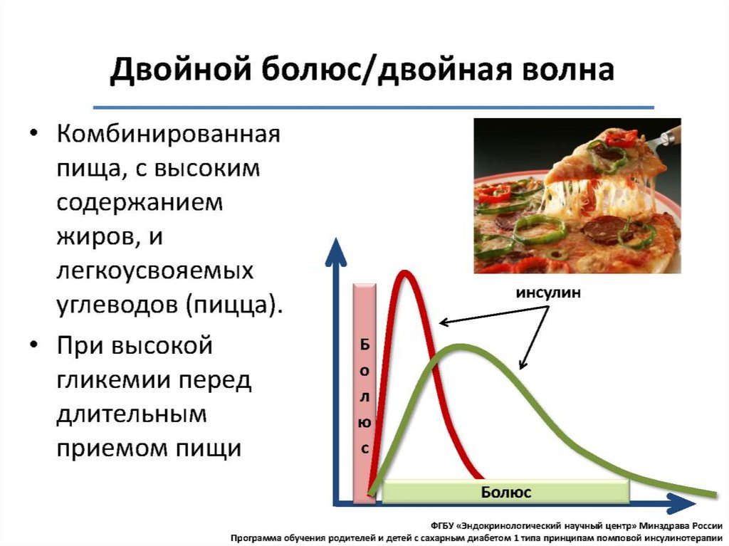 Помповая инсулинотерапия презентация