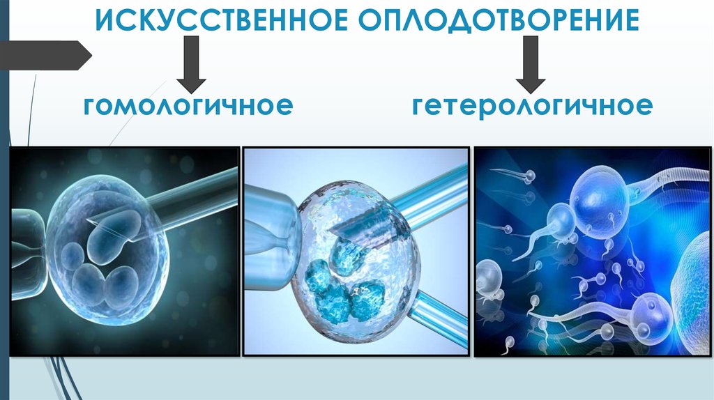 Как происходит искусственное оплодотворение. Гомологичная искусственная инсеминация. Эко это искусственное оплодотворение. Искусстсвенноеоплодотворение. Процесс искусственного оплодотворения.